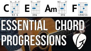 Chord Progression Practice  C E Am F  Beginner Guitar Lessons [upl. by Gordon]