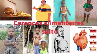 éducation nutritionnelle et hygiène de lappareil digestif 🔻 partie 4 carences alimentaires quotsuitequot [upl. by Tyrus]