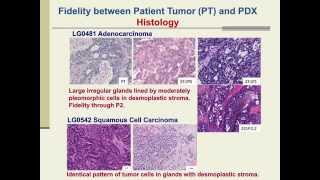 PatientDerived Xenografts for Cancer Therapeutics Development and Predictive Modeling [upl. by Onnem]