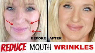 Get RID Of MOUTH WRINKLES WithOUT Fillers [upl. by Ailb]