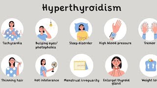 Hyperthyroidism  Easy amp Important topic in Hindi  Thyroidectomy  Nursing Management🙏😊 [upl. by Pressman]