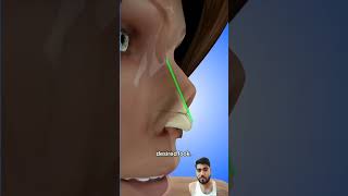 piercing beauty skincare satisfying nose nosejobs rhinoplastycost plasticsurgery rhinoplast [upl. by Montague616]