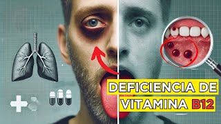 🚨 ¡ALERTA ⚠️ Tu Cuerpo te Está GRITANDO que Necesita VITAMINA B12 🚨 ¡Conoce las 13 SEÑALES [upl. by Torp763]