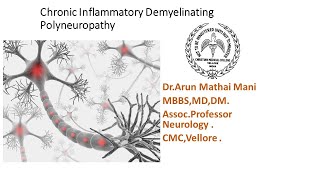 Chronic Inflammatory Demyelinating Polyneuropathy CIDP  DrArun Mathai CMC Vellore [upl. by Nadnerb]