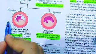 Ischemic heart diseasePathology of Ischemic heart diseaseAcute plaque changesRobbins pathology [upl. by Worra]