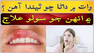 Why are there herpetic stomatitis in the mouth [upl. by Bernarr]