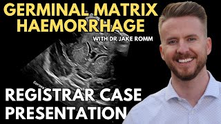 Germinal Matrix Haemorrhage  Cranial Ultrasound  Registrar Sessions [upl. by Oswin317]