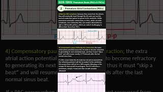 ECG EKG 2 Premature Atrial Contractions PACs [upl. by Arielle]