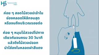 วิธีการตรวจคัดกรองมะเร็งปากมดลูก HPV DNA TEST [upl. by Theda]