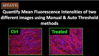 Quantify Mean Fluorescence Intensities of two different images using Manual amp Auto Threshold methods [upl. by Odlanra41]