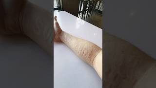 Have you heard of SKIN WRITING skinwriting dermatographia JJJreact [upl. by Hutchins]