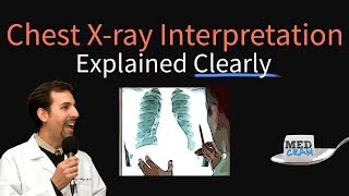 Chest XRay Interpretation Explained Clearly  How to read a CXR [upl. by Estele]