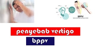 PENYEBAB VERTIGO  BPPV  PENYAKIT PENYEBAB VERTIGO PERIFER [upl. by Shoifet699]