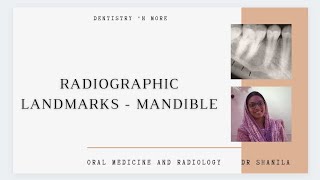 RADIOGRAPHICAL LANDMARKS MANDIBLEKindly use🎧 [upl. by Penrose604]