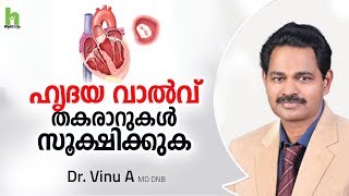 നിങ്ങളുടെ ഹൃദയ വാൽവുകൾ സുരക്ഷിതമാണോ  Heart valve disease malayalam [upl. by Eidnac966]