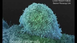 What Does Cancer Look Like  Cancer Research UK [upl. by Hirsh877]