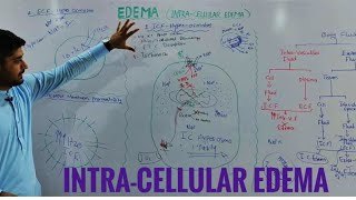 Intracellular edema pathophysiologyedema part 2 [upl. by Homere239]