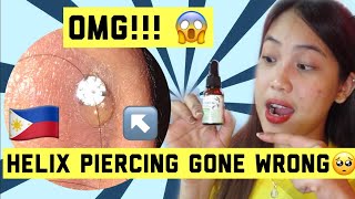 HOW TO TREAT PIERCING BUMPS tea tree oil  salt water PHILIPPINES [upl. by Avika]