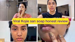 Skin lightening soap  Kojie san soap most honest review Yashi Tank [upl. by Circosta]