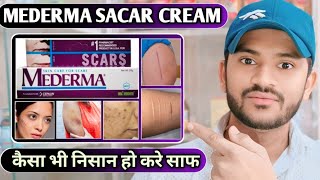 Medrma scar cream use dose benefits and side effects full review hindi [upl. by Oriana]