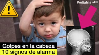 CUIDADO con los golpes en la cabeza en niños [upl. by Gytle]