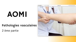 AOMI  Pathologies vasculaires 2ème partie [upl. by Oca]