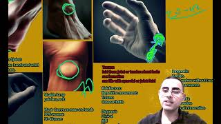 Lump on the wrist  Ganglion cyst symptoms causes treatment prognosis [upl. by Cataldo]