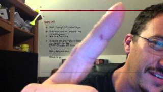 Nail Gun Put a Nail Through My Finger  33  My Garage Build HD Time Lapse [upl. by Eeryk306]