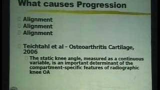 Lecture  High Tibial Osteotomy for Knee Arthritis  Part 1 [upl. by Guzel]