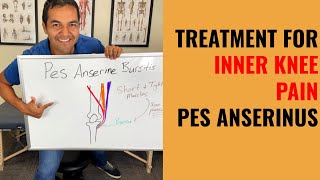 How To Cure Inner Knee Pain Caused By Pes Anserine Bursitis Easy Self Treatment That Works [upl. by Chin]