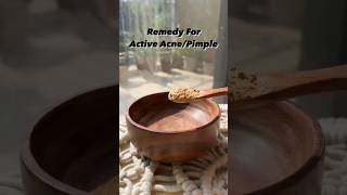 How to get rid of Acne  Acne treatment at home  pimples removal on face at home  short skincare [upl. by Tamiko]