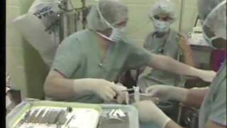 Hospital Dentistry Using General Anesthesia [upl. by Bergeman]