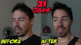 21 Day Water Fast What I Healed and What Id Do Different [upl. by Valentin763]