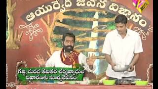 గజ్జితామర పోవాలంటే Ayurvedic Remedies for Ringworm Andariki Ayurvedam [upl. by Eldora869]