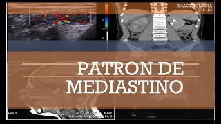 PatroÌn de Mediastino [upl. by Lichter]