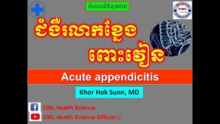 ជំងឺរលាកខ្នែង ពោះវៀន ll Acute appendicitis symptoms and prevention l cmlhealthscienceofficial [upl. by Cirde794]