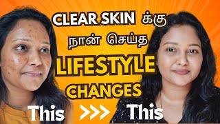 Acne to clear skin journey  This lifestyle changes for clear glowing Skin ✨️ acne acnetreatment [upl. by Turrell]