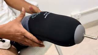 Below Knee Artificial Leg with Silicon Liner 7982083510  9971211546 [upl. by Aicened49]