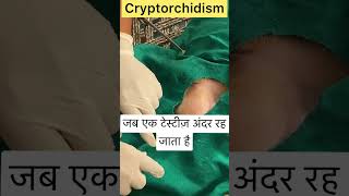 Cryptorchidism l Dr Umar Khan [upl. by Yellek]