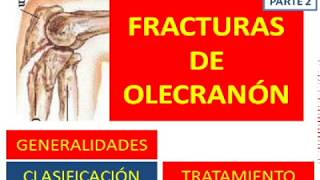 fractura de olecranon parte 2 [upl. by Scarlett218]