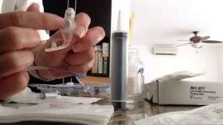 Diferencia entre botón y sonda foley para gastrostomia [upl. by Ardnait]