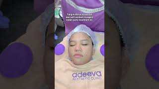 Skincare perawatan wajah shortvideo shorts short [upl. by Asyral769]