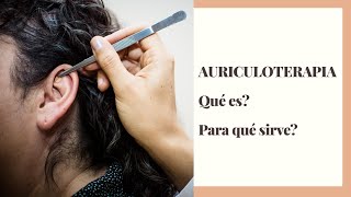 Auriculoterapia qué es y para qué sirve [upl. by Maurene693]