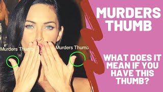 Murders Thumb – What Does it Mean if You Have a Clubbed Thumb Brachydactyly – Hand Analysis [upl. by Roe531]