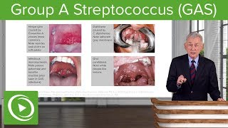 Group A Streptococcus GAS – Infectious Diseases  Lecturio [upl. by Ahsitram242]