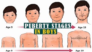 Puberty for boys stages 5 Things to Expect When Puberty Hits Boys [upl. by Nodanrb]