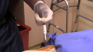 Live Intraarticular Hip Injection with a Hip Replacement [upl. by Trix]