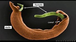 Trematoda 3 Schistosoma [upl. by Hgielrebma]