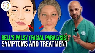 Bells Palsy Facial Paralysis Symptoms amp Treatment Options [upl. by Korwin]