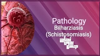 Bilharziasis  schistosomasis patho L10 [upl. by Ruffin]